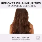 L’oréal Paris Elseve Hyaluron Pure Hair Balm for Oily Scalp and Dry Ends 200 Ml Фото 1