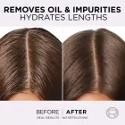 L’oréal Paris Elseve Hyaluron Pure Hair Balm for Oily Scalp and Dry Ends 300 Ml Фото 10