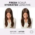 L’oréal Paris Elseve Hyaluron Pure Hair Balm for Oily Scalp and Dry Ends 200 Ml Фото 5