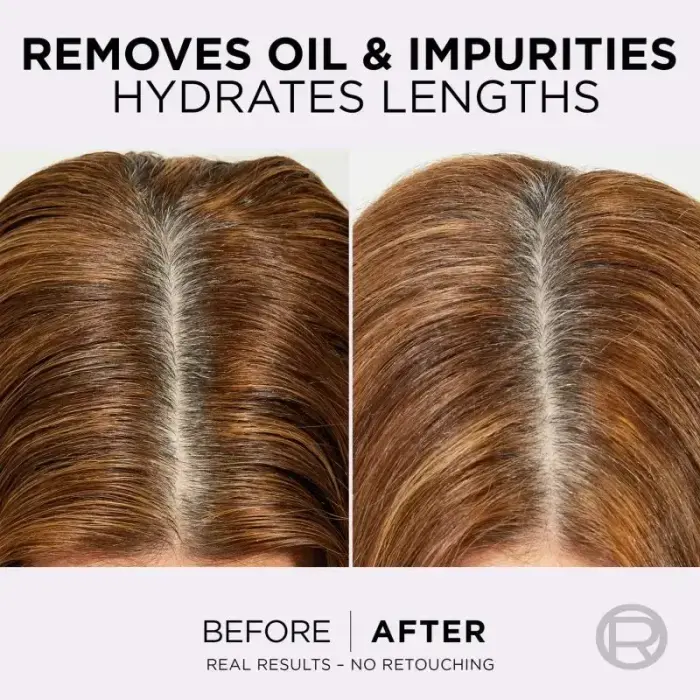L’oréal Paris Elseve Hyaluron Pure Hair Balm for Oily Scalp and Dry Ends 300 Ml Фото 3