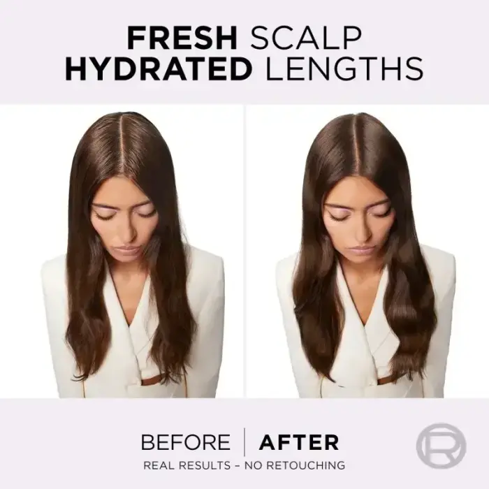 L’oréal Paris Elseve Hyaluron Pure Hair Balm for Oily Scalp and Dry Ends 300 Ml Фото 6