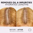 L’oréal Paris Elseve Hyaluron Pure Hair Balm for Oily Scalp and Dry Ends 300 Ml Фото 8