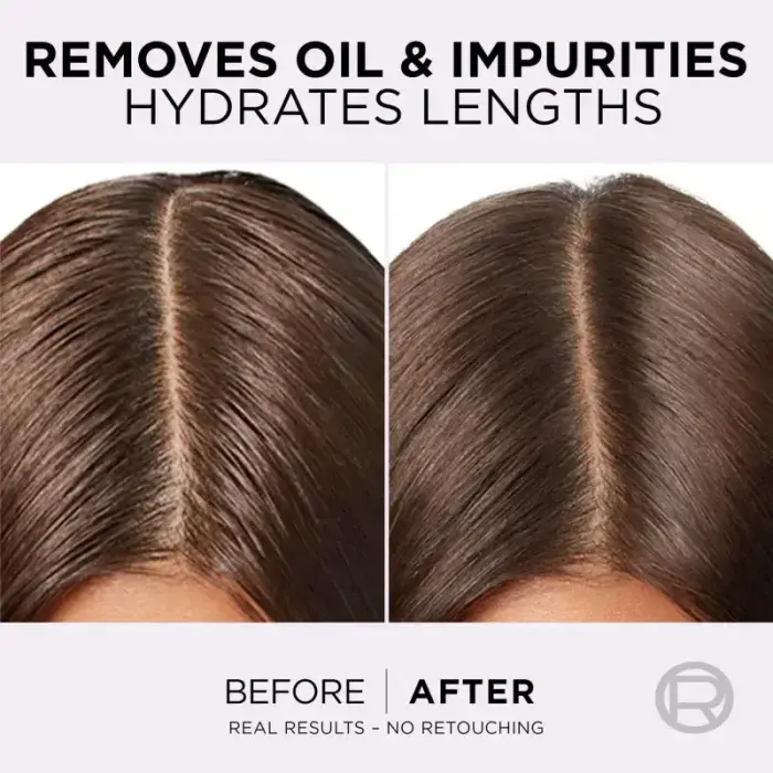 L’oréal Paris Elseve Hyaluron Pure Hair Balm for Oily Scalp and Dry Ends 200 Ml Фото 9