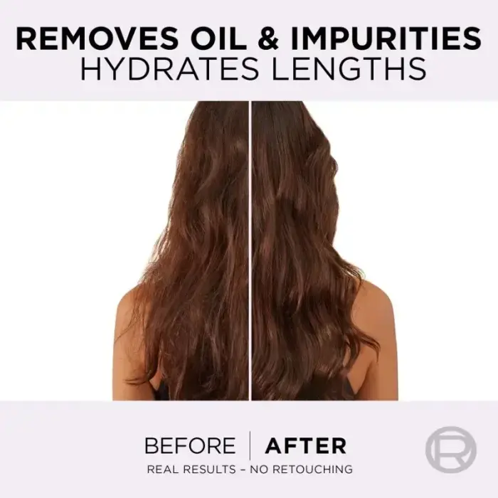 L’oréal Paris Elseve Hyaluron Pure Hair Balm for Oily Scalp and Dry Ends 300 Ml Фото 2